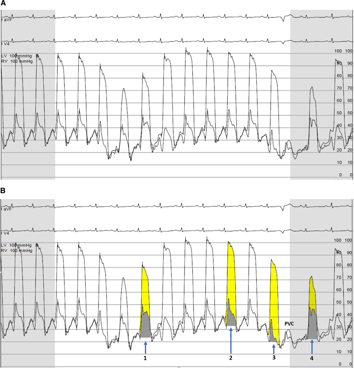 AHA/ASA Journals